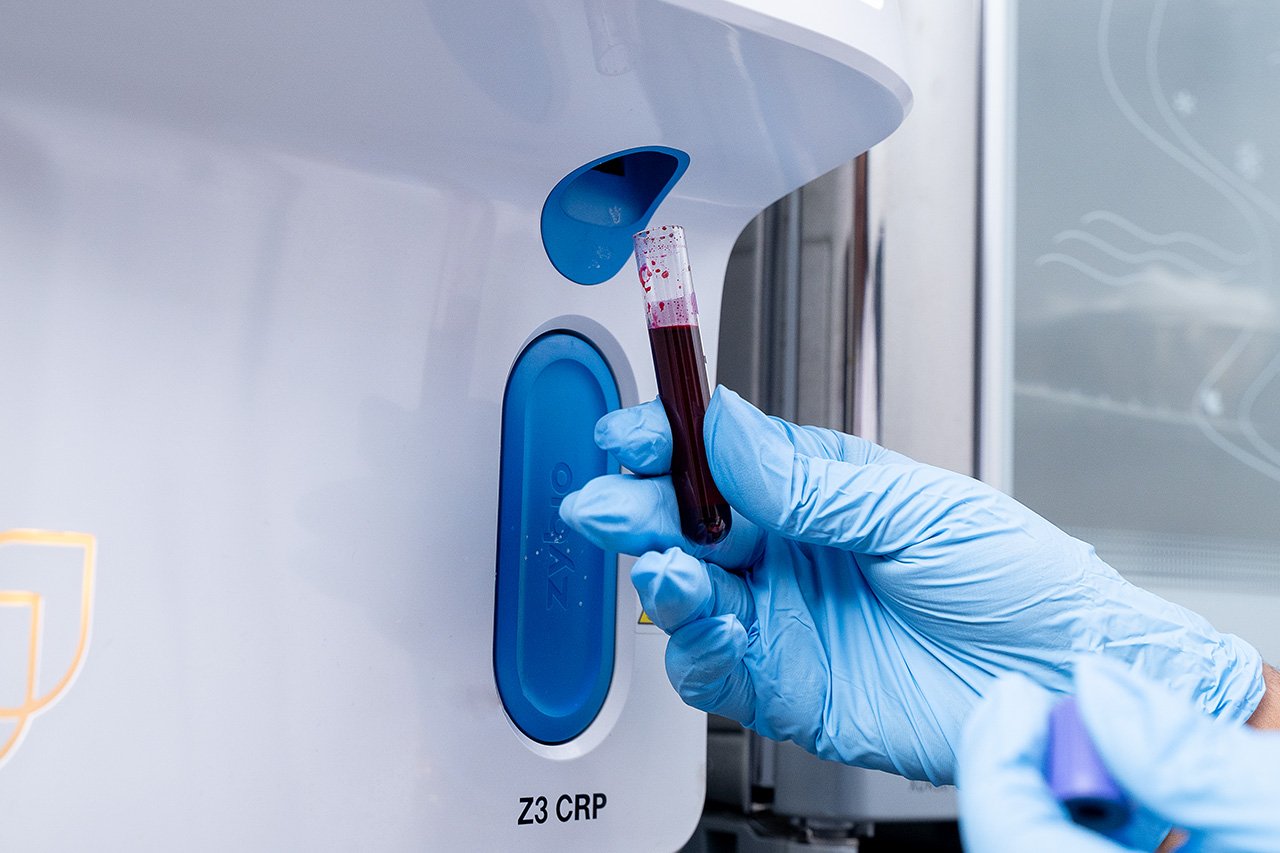 Diagnostic blood and urine tests conducted at Klinik Sentosa laboratory